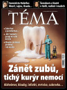 TÉMA